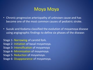 Moya Moya
• Chronic progressive arteriopathy of unknown cause and has
become one of the most common causes of pediatric stroke.
• Suzuki and Kodama classified the evolution of moyamoya disease
using angiographic findings to define six phases of the disease:
Stage 1- Narrowing of carotid fork.
Stage 2- Initiation of basal moyamoya.
Stage 3- Intensification of moyamoya
Stage 4- Minimization of moyamoya.
Stage 5- Reduction of moyamoya .
Stage 6- Disappearance of moyamoya.
 