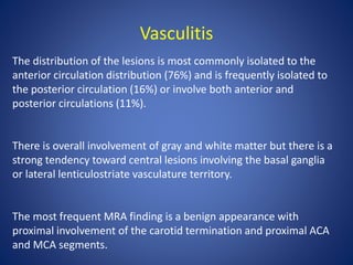 Vasculitis
The distribution of the lesions is most commonly isolated to the
anterior circulation distribution (76%) and is frequently isolated to
the posterior circulation (16%) or involve both anterior and
posterior circulations (11%).
There is overall involvement of gray and white matter but there is a
strong tendency toward central lesions involving the basal ganglia
or lateral lenticulostriate vasculature territory.
The most frequent MRA finding is a benign appearance with
proximal involvement of the carotid termination and proximal ACA
and MCA segments.
 