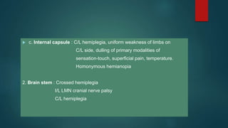  c. Internal capsule : C/L hemiplegia, uniform weakness of limbs on
C/L side, dulling of primary modalities of
sensation-touch, superficial pain, temperature.
Homonymous hemianopia
2. Brain stem : Crossed hemiplegia
I/L LMN cranial nerve palsy
C/L hemiplegia
 