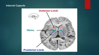Internal Capsule
 