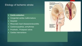 Etiology of Ischemic stroke
 Cardio embolism
 Congenital cardiac malformations
 Acquired
 Rheumatic heart disease/endocarditis
 Cardiomyopathies, arrhythmias
 Prosthetic , Prolapsed valves
 Cardiac interventions
 