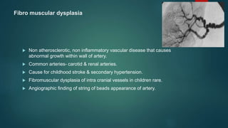 Fibro muscular dysplasia
 Non atherosclerotic, non inflammatory vascular disease that causes
abnormal growth within wall of artery.
 Common arteries- carotid & renal arteries.
 Cause for childhood stroke & secondary hypertension.
 Fibromuscular dysplasia of intra cranial vessels in children rare.
 Angiographic finding of string of beads appearance of artery.
 