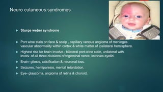 Neuro cutaneous syndromes
 Sturge weber syndrome
 Port wine stain on face & scalp , capillary venous angioma of meninges,
vascular abnormality within cortex & white matter of ipsilateral hemisphere.
 Highest risk for brain involve.- bilateral port-wine stain, unilateral with
involv. of all three divisions of trigeminal nerve, involves eyelid.
 Brain- gliosis, calcification & neuronal loss.
 Seizures, hemiparesis, mental retardation.
 Eye- glaucoma, angioma of retina & choroid.
 