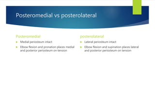 Posteromedial vs posterolateral
Posteromedial
 Medial periosteum intact
 Elbow flexion and pronation places medial
and posterior periosteum on tension
posterolateral
 Lateral periosteum intact
 Elbow flexion and supination places lateral
and posterior periosteum on tension
 