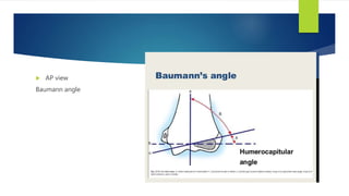  AP view
Baumann angle
 