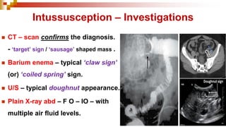 Pediatric Surgery - IHPS / ISS / Hirschsprung's Disease & ARM | PDF