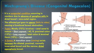 Long Segment Pediatric Surgery - IHPS / ISS / Hirschsprung's Disease & ARM | PDF