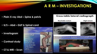 Pediatric Surgery - IHPS / ISS / Hirschsprung's Disease & ARM | PDF