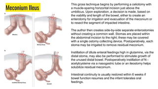 Pediatric surgery Gi abnormalities.pptx
