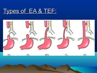 Types of EA & TEF:Types of EA & TEF:
 