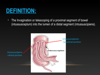 DEFINITION:
• The Invagination or telescoping of a proximal segment of bowel
(intussusceptum) into the lumen of a distal segment (intussuscipiens).
Intussusceptum
=proximal portion
Intussuscipens
=distal portion
 