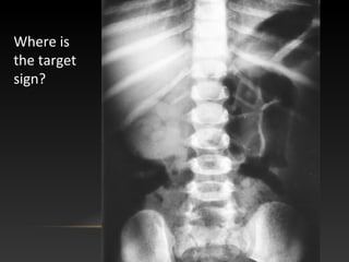 Where is
the target
sign?
 