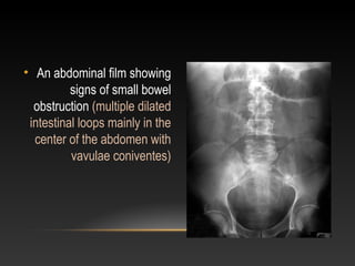 • An abdominal film showing
signs of small bowel
obstruction (multiple dilated
intestinal loops mainly in the
center of the abdomen with
vavulae coniventes)
 