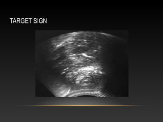 TARGET SIGN
 