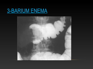 3-BARIUM ENEMA
 