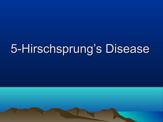 5-Hirschsprung’s Disease5-Hirschsprung’s Disease
 