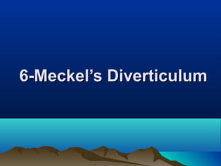 6-Meckel’s Diverticulum6-Meckel’s Diverticulum
 