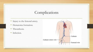 Complications
• Injury to the femoral artery.
• Hematoma formation.
• Thrombosis.
• Infection.
 