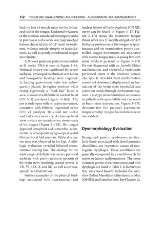 112  Pediatric Swallowing and Feeding: Assessment and Management
leads to loss of muscle mass on the ipsilat-
eral side of the tongue. Unilateral weakness
of the extrinsic muscles of the tongue results
in protrusion to the weak side. Supranuclear
lesions characteristic of CP result in weak-
ness, without muscle atrophy or fascicula-
tions, as well as poorly coordinated tongue
movements.
A 26-week gestation, preterm male infant
at 41 weeks’ PMA is seen in Figure 3–16.
Perinatal history was significant for severe
asphyxia. Prolonged mechanical ventilation
and nasogastric feedings were required.
A feeding gastrostomy tube was subse-
quently placed. In supine position while
crying vigorously, a “mask-like” facies is
seen, consistent with bilateral nuclear facial
(CN VII) paralysis (Figure 3–16A). The
jaw is wide open with no active movement,
consistent with bilateral trigeminal nerve
(CN V) paralysis. He could not suckle
and had a very weak cry. A close-up facial
view reveals no spontaneous movements
of his tongue (Figure 3–16B). His tongue
appeared atrophied and somewhat asym-
metric. A subsequent laryngoscopy revealed
bilateral vocal fold paralysis. Bilateral exten-
sor tone was observed in his legs. Audio-
logic evaluation revealed bilateral senso-
rineural hearing loss. The etiology for the
wide range of deficits was severe perinatal
asphyxia with patchy ischemic necrosis of
his brain stem involving cranial nerves V,
VII, VIII, IX, X, and XII, as well as cortico-
spinal tract dysfunction.
Further examples of the physical find-
ings associated with supranuclear and
nuclear lesions of the hypoglossal (CN XII)
nerve can be found in Figure 3–17. Fig-
ure 3–17A shows the prominent tongue
thrust reflex in a 27-month-old girl with CP.
Reflexive protrusion of the tongue is spon-
taneous and on examination poorly con-
trolled tongue movements are associated
with normal tongue mass. A young boy with
spina bifida is pictured in Figure 3–17B.
He was diagnosed with an Arnold-Chiari
malformation and received a ventricular
peritoneal shunt in the newborn period.
The type II Arnold-Chiari malformation
consists of downward displacement or her-
niation of the brain stem (medulla) and
cerebellar tonsils through the foramen mag-
num. This type of malformation is common
in patients with spina bifida and can result
in brain-stem dysfunction. Figure 3–17C
demonstrates the patient’s asymmetric
tongue atrophy. Tongue fasciculations were
also evident.
Dysmorphology Evaluation
Recognized genetic syndromes, particu-
larly those associated with developmental
disabilities, are important causes of neu-
rogenic dysphagia. These conditions are
generally recognized by a careful search for
major or minor malformations. The more
common genetic syndromes associated with
dysphagia are listed in Table 3–6. References
that were used heavily included the web-
sites Online Mendelian Inheritance in Man
(OMIM) and GeneReviews. See Chapter 12.
 
