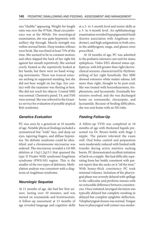 140  Pediatric Swallowing and Feeding: Assessment and Management
was “chubby” appearing. Weight-for-length
ratio was over the 97%ile. Head circumfer-
ence was at the 90%ile. On neurological
examination, she was quite hypotonic with
axillary slip through. Muscle strength was
within normal limits. Deep tendon reflexes
were brisk. She was fisted at least 75% of the
time. She seemed to be in constant motion,
and often slapped the back of her right fist
against her mouth repetitively. She seemed
overly fixated as she repetitively looked at
her hands, but there were no hand wring-
ing movements. There was truncal exten-
sor arching in supported standing, but she
did not bear weight on her legs. Eye con-
tact with the examiner was fleeting at best.
She did not reach for objects. Cranial MRI
was normal. Chemistry panel, T4, and TSH
were normal. She was referred to the Genet-
ics service for evaluation of possible atypical
Rett syndrome.
Genetics Evaluation
PC was seen by a geneticist at 10 months
of age. Notable physical findings included a
symmetrical but “wide” face, and deep-set
eyes, tapering fingers, and diffuse hypoto-
nia. No definite syndrome could be iden-
tified, and a chromosome microarray was
ordered. The microarray revealed a 4.8 Mb
deletion at 15q11.2q13.1 that spanned the
type II Prader-Willi syndrome/Angelman
syndrome (PWS/AS) region. This is the
smaller of the two types of deletions. Meth-
ylation analysis was consistent with a diag-
nosis of Angelman syndrome.
Neurologic Sequelae
At 11 months of age, she had her first sei-
zure, lasting over 10 minutes, and was
started on zonisamide and levetiracetam.
A follow-up assessment at 13 months of
age revealed language and cognitive skills
at a 2- to 3-month level and motor skills at
a 3- to 4-month level. An ophthalmology
examination revealed hypopigmented fundi
(known association with Angelman syn-
drome), and high astigmatism in both eyes,
in the amblyogenic range, and glasses were
prescribed.
At 18 months of age, PC was admitted
to the pediatric intensive care unit for status
epilepticus. Video EEG showed status epi-
lepticus, with left greater than right electro-
clinical seizures, characterized by rhythmic
jerking of her right hemibody. Her MRI
showed extensive white matter edema, left
more than right, thought to be post-ictal.
She was treated with benzodiazeoines, fos-
phenytoin, and lacosamide. Eventually her
seizures resolved, and she was discharged
home on zonisamide, clorazepate, and
lacosamide. Because of feeding difficulties,
she was sent home with an NG tube.
Feeding Follow-Up
A follow-up VFSS was completed at 18
months of age with thickened liquids pre-
sented via Dr. Brown bottle with Stage 3
nipple. The patient tolerated the exam
well. Oral bolus control and preparation
were moderately reduced with limited milk
transfer during active nutritive sucking
bursts. PC demonstrated excellent initiation
of latch on a nipple. She had difficulty sepa-
rating from her bottle consistent with par-
ent report that she sucks on it “all the time.”
With honey-thick consistency PC took
minimal volumes. Initiation of the pharyn-
geal phase was severely delayed with spillage
to the valleculae and pyriform sinuses with
no noticeable difference between consisten-
cies. Once initiated, laryngeal elevation was
typically delayed but complete resulting in
delayed but complete epiglottic deflection.
Velopharyngeal closure was normal. Tongue
base to pharyngeal wall contact was moder-
 