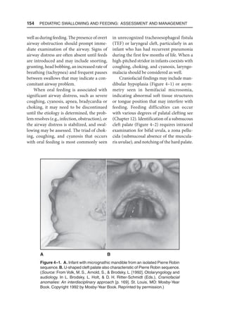 154  Pediatric Swallowing and Feeding: Assessment and Management
well as during feeding. The presence of overt
airway obstruction should prompt imme-
diate examination of the airway. Signs of
airway distress are often absent until feeds
are introduced and may include snorting,
grunting, head bobbing, an increased rate of
breathing (tachypnea) and frequent pauses
between swallows that may indicate a con-
comitant airway problem.
When oral feeding is associated with
significant airway distress, such as severe
coughing, cyanosis, apnea, bradycardia or
choking, it may need to be discontinued
until the etiology is determined, the prob-
lem resolves (e.g., infection, obstruction), or
the airway distress is stabilized, and swal-
lowing may be assessed. The triad of chok-
ing, coughing, and cyanosis that occurs
with oral feeding is most commonly seen
in unrecognized tracheoesophageal fistula
(TEF) or laryngeal cleft, particularly in an
infant who has had recurrent pneumonia
during the first few months of life. When a
high-pitched stridor in infants coexists with
coughing, choking, and cyanosis, laryngo-
malacia should be considered as well.
Craniofacial findings may include man-
dibular hypoplasia (Figure 4–1) or asym-
metry seen in hemifacial microsomia,
indicating abnormal soft tissue structures
or tongue position that may interfere with
feeding. Feeding difficulties can occur
with various degrees of palatal clefting see
(Chapter 12). Identification of a submucous
cleft palate (Figure 4–2) requires intraoral
examination for bifid uvula, a zona pellu-
cida (submucosal absence of the muscula-
ris uvulae), and notching of the hard palate.
Figure 4–1. A. Infant with micrognathic mandible from an isolated Pierre Robin
sequence. B. U-shaped cleft palate also characteristic of Pierre Robin sequence.
(Source: From Volk, M. S., Arnold, S.,  Brodsky, L. [1992]. Otolaryngology and
audiology. In L. Brodsky, L. Holt,  D. H. Ritter-Schmidt (Eds.), Craniofacial
anomalies: An interdisciplinary approach [p. 169]. St. Louis, MO: Mosby-Year
Book. Copyright 1992 by Mosby-Year Book. Reprinted by permission.)
A B
 