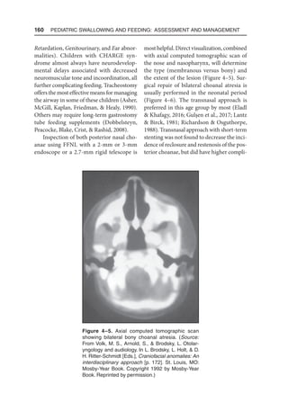 160  Pediatric Swallowing and Feeding: Assessment and Management
Retardation, Genitourinary, and Ear abnor-
malities). Children with CHARGE syn-
drome almost always have neurodevelop-
mental delays associated with decreased
neuromuscular tone and incoordination, all
further complicating feeding. Tracheostomy
offers the most effective means for managing
the airway in some of these children (Asher,
McGill, Kaplan, Friedman,  Healy, 1990).
Others may require long-term gastrostomy
tube feeding supplements (Dobbelsteyn,
Peacocke, Blake, Crist,  Rashid, 2008).
Inspection of both posterior nasal cho-
anae using FFNL with a 2-mm or 3-mm
endoscope or a 2.7-mm rigid telescope is
most helpful. Direct visualization, combined
with axial computed tomographic scan of
the nose and nasopharynx, will determine
the type (membranous versus bony) and
the extent of the lesion (Figure 4–5). Sur-
gical repair of bilateral choanal atresia is
usually performed in the neonatal period
(Figure 4–6). The transnasal approach is
preferred in this age group by most (Eladl
 Khafagy, 2016; Gulşen et al., 2017; Lantz
 Birck, 1981; Richardson  Osguthorpe,
1988). Transnasal approach with short-term
stenting was not found to decrease the inci-
dence of reclosure and restenosis of the pos-
terior choanae, but did have higher compli-
Figure 4–5. Axial computed tomographic scan
showing bilateral bony choanal atresia. (Source:
From Volk, M. S., Arnold, S.,  Brodsky, L. Otolar-
yngology and audiology. In L. Brodsky, L. Holt,  D.
H. Ritter-Schmidt [Eds.], Craniofacial anomalies: An
interdisciplinary approach [p. 172]. St. Louis, MO:
Mosby-Year Book. Copyright 1992 by Mosby-Year
Book. Reprinted by permission.)
 