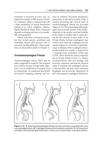4. The Upper Airway and Swallowing  167
evaluation is necessary in every case. An
important example is PRS as part of Stick-
ler syndrome, which is characterized with
a high probability of retinal detachment
(Mingo et al., 2016; Vilaplana, Muiños,
Nadal, Elizalde,  Mojal, 2015). Treatment
depends on etiology and may vary consider-
ably among patients.
Infants with other craniofacial anoma-
lies that include genetic syndromes and
neurologic disease often present with, or
encounter, feeding difficulties. These condi-
tions are discussed in depth in Chapter 12.
Tracheoesophageal Fistula
Tracheoesophageal fistula (TEF) may be
either congenital or acquired. The acquired
forms follow trauma, foreign-body inges-
tion, or are a complication of surgery, such
as tracheotomy. As mentioned previously,
the triad of coughing, choking, and cya-
nosis is common. Recurrent pneumonia,
particularly in the first 6 months of life, is
another presenting sign. Several types of
tracheoesophageal fistulae are described
(Figure 4–12). Those presenting with esoph-
ageal atresia usually present with polyhy-
dramnios in the mother and total inability
of the infant to swallow that is noted dur-
ing the first attempt to feed orally. In an
H-type fistula, barium esophagram may
reveal a tract from the esophagus into the
trachea (Figure 4–13); however, rigid endo-
scopic evaluation of the esophagus and tra-
cheobronchial tree usually is required for
a comprehensive evaluation of this type
of TEF. There should be clinical suspicion
for an H-type fistula if there is a history
of desaturations with oral feedings and
recurrent aspiration pneumonia. Surgical
repair is required, but esophageal stenosis
at the operative site may cause continued
dysphagia and necessitate adjustment of
diet and repeated esophageal dilatations.
Figure 4–12. A. Distal tracheoesophageal fistulae are most commonly associated with proxi-
mal esophageal atresia. B. Esophageal atresia without tracheal connection. C. Of this group of
anomalies, tracheoesophageal fistula alone, known as an H-type fistula, is the least common.
 