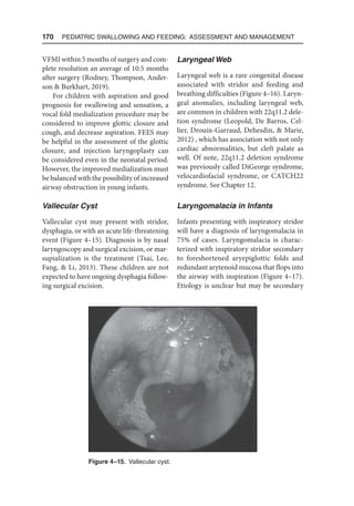 170  Pediatric Swallowing and Feeding: Assessment and Management
VFMI within 5 months of surgery and com-
plete resolution an average of 10.5 months
after surgery (Rodney, Thompson, Ander-
son  Burkhart, 2019).
For children with aspiration and good
prognosis for swallowing and sensation, a
vocal fold medialization procedure may be
considered to improve glottic closure and
cough, and decrease aspiration. FEES may
be helpful in the assessment of the glottic
closure, and injection laryngoplasty can
be considered even in the neonatal period.
However, the improved medialization must
be balanced with the possibility of increased
airway obstruction in young infants.
Vallecular Cyst
Vallecular cyst may present with stridor,
dysphagia, or with an acute life-threatening
event (Figure 4–15). Diagnosis is by nasal
laryngoscopy and surgical excision, or mar-
supialization is the treatment (Tsai, Lee,
Fang,  Li, 2013). These children are not
expected to have ongoing dysphagia follow-
ing surgical excision.
Laryngeal Web
Laryngeal web is a rare congenital disease
associated with stridor and feeding and
breathing difficulties (Figure 4–16). Laryn-
geal anomalies, including laryngeal web,
are common in children with 22q11.2 dele-
tion syndrome (Leopold, De Barros, Cel-
lier, Drouin-Garraud, Dehesdin,  Marie,
2012) , which has association with not only
cardiac abnormalities, but cleft palate as
well. Of note, 22q11.2 deletion syndrome
was previously called DiGeorge syndrome,
velocardiofacial syndrome, or CATCH22
syndrome. See Chapter 12.
Laryngomalacia in Infants
Infants presenting with inspiratory stridor
will have a diagnosis of laryngomalacia in
75% of cases. Laryngomalacia is charac-
terized with inspiratory stridor secondary
to foreshortened aryepiglottic folds and
redundant arytenoid mucosa that flops into
the airway with inspiration (Figure 4–17).
Etiology is unclear but may be secondary
Figure 4–15. Vallecular cyst.
 