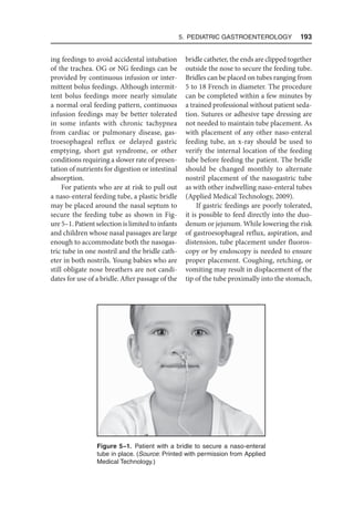 5. Pediatric Gastroenterology  193
ing feedings to avoid accidental intubation
of the trachea. OG or NG feedings can be
provided by continuous infusion or inter-
mittent bolus feedings. Although intermit-
tent bolus feedings more nearly simulate
a normal oral feeding pattern, continuous
infusion feedings may be better tolerated
in some infants with chronic tachypnea
from cardiac or pulmonary disease, gas-
troesophageal reflux or delayed gastric
emptying, short gut syndrome, or other
conditions requiring a slower rate of presen-
tation of nutrients for digestion or intestinal
absorption.
For patients who are at risk to pull out
a naso-enteral feeding tube, a plastic bridle
may be placed around the nasal septum to
secure the feeding tube as shown in Fig-
ure 5–1. Patient selection is limited to infants
and children whose nasal passages are large
enough to accommodate both the nasogas-
tric tube in one nostril and the bridle cath-
eter in both nostrils. Young babies who are
still obligate nose breathers are not candi-
dates for use of a bridle. After passage of the
bridle catheter, the ends are clipped together
outside the nose to secure the feeding tube.
Bridles can be placed on tubes ranging from
5 to 18 French in diameter. The procedure
can be completed within a few minutes by
a trained professional without patient seda-
tion. Sutures or adhesive tape dressing are
not needed to maintain tube placement. As
with placement of any other naso-enteral
feeding tube, an x-ray should be used to
verify the internal location of the feeding
tube before feeding the patient. The bridle
should be changed monthly to alternate
nostril placement of the nasogastric tube
as with other indwelling naso-enteral tubes
(Applied Medical Technology, 2009).
If gastric feedings are poorly tolerated,
it is possible to feed directly into the duo-
denum or jejunum. While lowering the risk
of gastroesophageal reflux, aspiration, and
distension, tube placement under fluoros-
copy or by endoscopy is needed to ensure
proper placement. Coughing, retching, or
vomiting may result in displacement of the
tip of the tube proximally into the stomach,
Figure 5–1. Patient with a bridle to secure a naso-enteral
tube in place. (Source: Printed with permission from Applied
Medical Technology.)
 