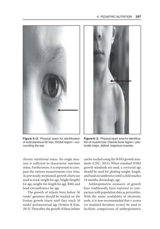 6. Pediatric Nutrition  247
chronic nutritional status. No single mea-
sure is sufficient to characterize nutrition
status. Furthermore, it is important to com-
pare the various measurements over time.
As previously mentioned, growth charts are
used to track weight for age, height (length)
for age, weight-for-length for age, BMI, and
head circumference for age.
The growth of infants born before 36
weeks’ gestation should be tracked on the
Fenton growth charts until they reach 50
weeks’ postmenstrual age (Fenton  Kim,
2013). Thereafter, the growth of these infants
can be tracked using the WHO growth stan-
dards (CDC, 2013). When standard WHO
growth standards are used, a corrected age
should be used for plotting weight, length,
and head circumference until a child reaches
24 months chronologic age.
Anthropometric measures of growth
have traditionally been reported in com-
parison with population data as percentiles.
With the easier availability of electronic
tools, it is now recommended that z-scores
(or standard deviation scores) be used to
facilitate comparisons of anthropometric
Figure 6–2. Physical exam for identification
of subcutaneous fat loss. Orbital region—sur-
rounding the eye.
Figure 6–3. Physical exam area for identifica-
tion of muscle loss.Clavicle bone region—pec-
toralis major, deltoid, trapezius muscles.
 
