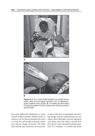 344  Pediatric Swallowing and Feeding: Assessment and Management
may need additional stabilization to attain
neutral midline position. Rolled towels or
cushions can be placed alongside the head
or trunk, but not metallic materials, which
may obscure images of interest. The child
must tolerate any restrictions of movement
so that a calm state is maintained. Position-
ing changes may be needed during an eval-
uation when difficulties become apparent,
most likely when the child is moved from
the typical to the anticipated optimal posi-
tion. For example, a 6‑month‑old infant
Figure 8–3. A. A child seated between the upright fluoro-
scopic table and the image intensifier prior to videofluoro-
scopic swallow study (VFSS). B. A 9-week-old infant taking
thin liquid by bottle for VFSS in lateral view. Parent is present-
ing the bottle.
B
A
 