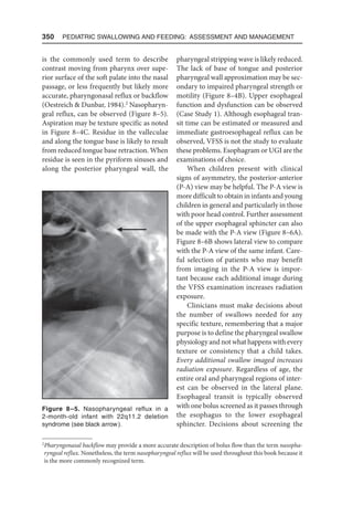 350  Pediatric Swallowing and Feeding: Assessment and Management
is the commonly used term to describe
contrast moving from pharynx over supe-
rior surface of the soft palate into the nasal
passage, or less frequently but likely more
accurate, pharyngonasal reflux or backflow
(Oestreich  Dunbar, 1984).2
Nasopharyn-
geal reflux, can be observed (Figure 8–5).
Aspiration may be texture specific as noted
in Figure 8–4C. Residue in the valleculae
and along the tongue base is likely to result
from reduced tongue base retraction. When
residue is seen in the pyriform sinuses and
along the posterior pharyngeal wall, the
pharyngeal stripping wave is likely reduced.
The lack of base of tongue and posterior
pharyngeal wall approximation may be sec-
ondary to impaired pharyngeal strength or
motility (Figure 8–4B). Upper esophageal
function and dysfunction can be observed
(Case Study 1). Although esophageal tran-
sit time can be estimated or measured and
immediate gastroesophageal reflux can be
observed, VFSS is not the study to evaluate
these problems. Esophagram or UGI are the
examinations of choice.
When children present with clinical
signs of asymmetry, the posterior-anterior
(P-A) view may be helpful. The P-A view is
more difficult to obtain in infants and young
children in general and particularly in those
with poor head control. Further assessment
of the upper esophageal sphincter can also
be made with the P-A view (Figure 8–6A).
Figure 8–6B shows lateral view to compare
with the P-A view of the same infant. Care-
ful selection of patients who may benefit
from imaging in the P-A view is impor-
tant because each additional image during
the VFSS examination increases radiation
exposure.
Clinicians must make decisions about
the number of swallows needed for any
specific texture, remembering that a major
purpose is to define the pharyngeal swallow
physiology and not what happens with every
texture or consistency that a child takes.
Every additional swallow imaged increases
radiation exposure. Regardless of age, the
entire oral and pharyngeal regions of inter-
est can be observed in the lateral plane.
Esophageal transit is typically observed
with one bolus screened as it passes through
the esophagus to the lower esophageal
sphincter. Decisions about screening the
2

Pharyngonasal backflow may provide a more accurate description of bolus flow than the term nasopha-
ryngeal reflux. Nonetheless, the term nasopharyngeal reflux will be used throughout this book because it
is the more commonly recognized term.
Figure 8–5. Nasopharyngeal reflux in a
2-month-old infant with 22q11.2 deletion
syndrome (see black arrow).
 