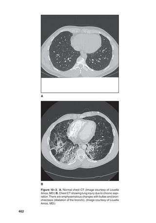 Pediatric_Swallowing_and_Feeding_Assessment_and_Management,_Third.pdf
