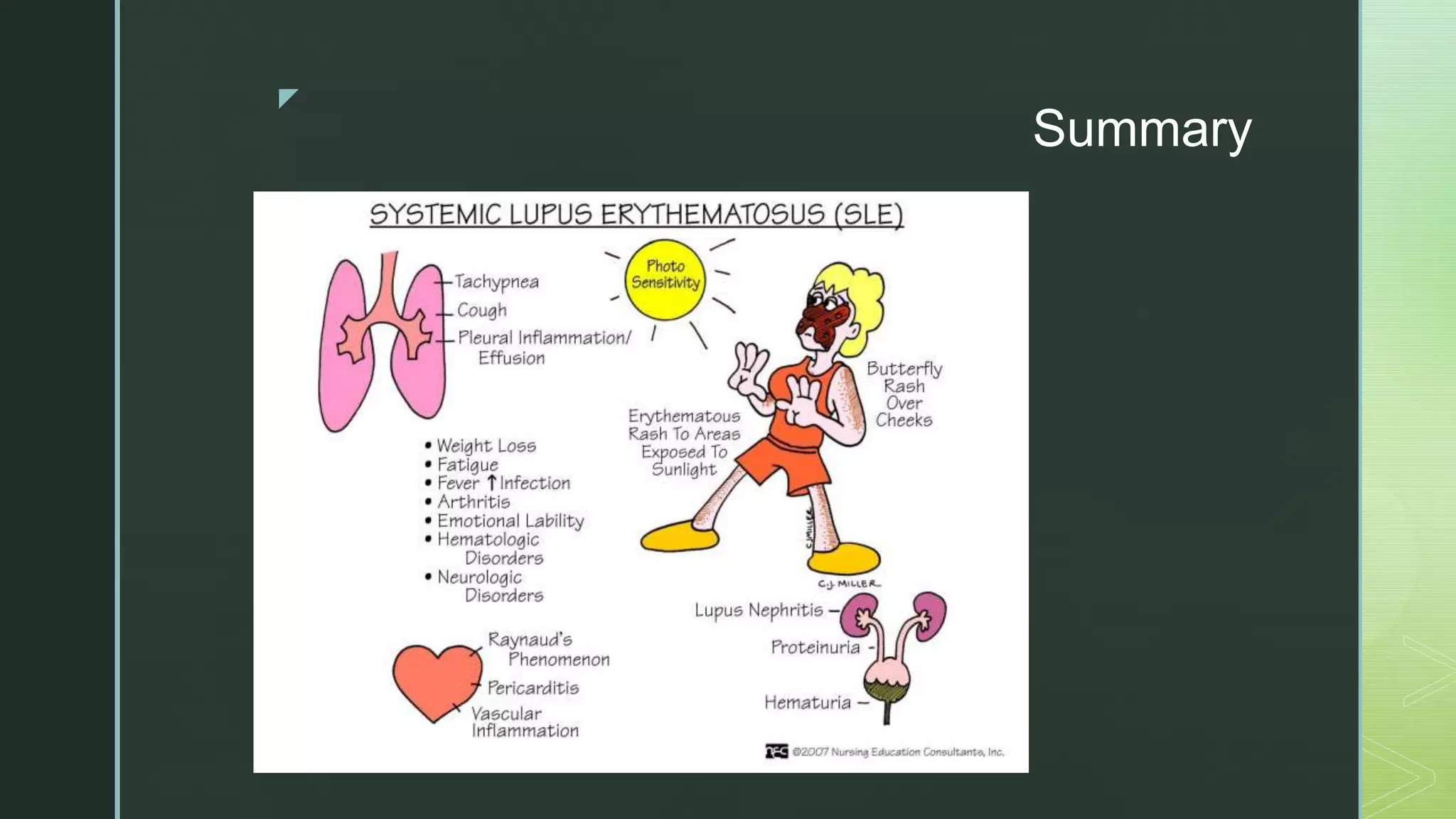 Pediatric systemic lupus erythematosus | PPTX