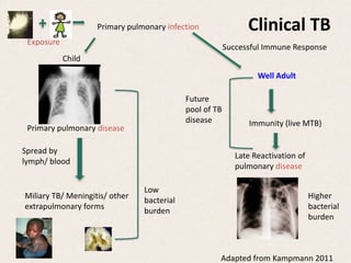 Pediatric TB and child health programming_Gnanashanmuga_5.2.12m