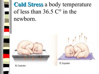 Cold StressCold Stress a body temperature
of less than 36.5 C° in the
newborn.
 