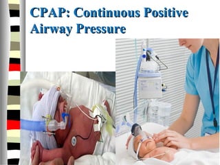 CPAP: Continuous PositiveCPAP: Continuous Positive
Airway PressureAirway Pressure
 