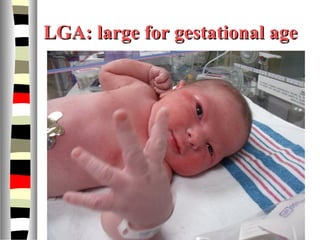 LGA: large for gestational ageLGA: large for gestational age
 