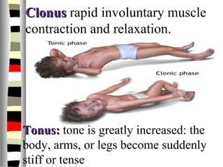 ClonusClonus rapid involuntary muscle
contraction and relaxation.
Tonus:Tonus: tone is greatly increased: the
body, arms, or legs become suddenly
stiff or tense
 