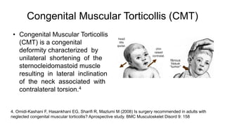 • Congenital Muscular Torticollis
(CMT) is a congenital
deformity characterized by
unilateral shortening of the
sternocleidomastoid muscle
resulting in lateral inclination
of the neck associated with
contralateral torsion.4
Congenital Muscular Torticollis (CMT)
4. Omidi-Kashani F, Hasankhani EG, Sharifi R, Mazlumi M (2008) Is surgery recommended in adults with
neglected congenital muscular torticollis? Aprospective study. BMC Musculoskelet Disord 9: 158
 