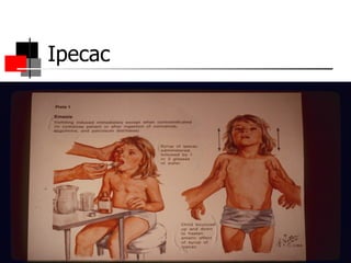 Ipecac 