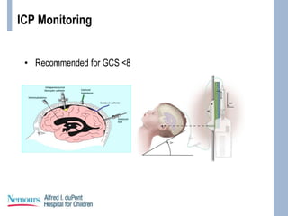 ICP Monitoring
• Recommended for GCS <8
 