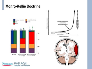Monro-Kellie Doctrine
 