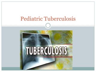 Pediatric Tuberculosis

 