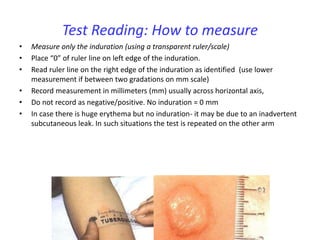 Pediatric tuberculosis | PPTX