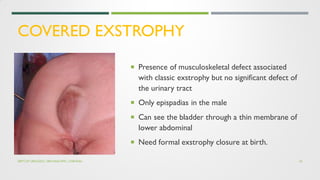 Pediatric urology:Bladder extrophy and Epispadias complex | PDF