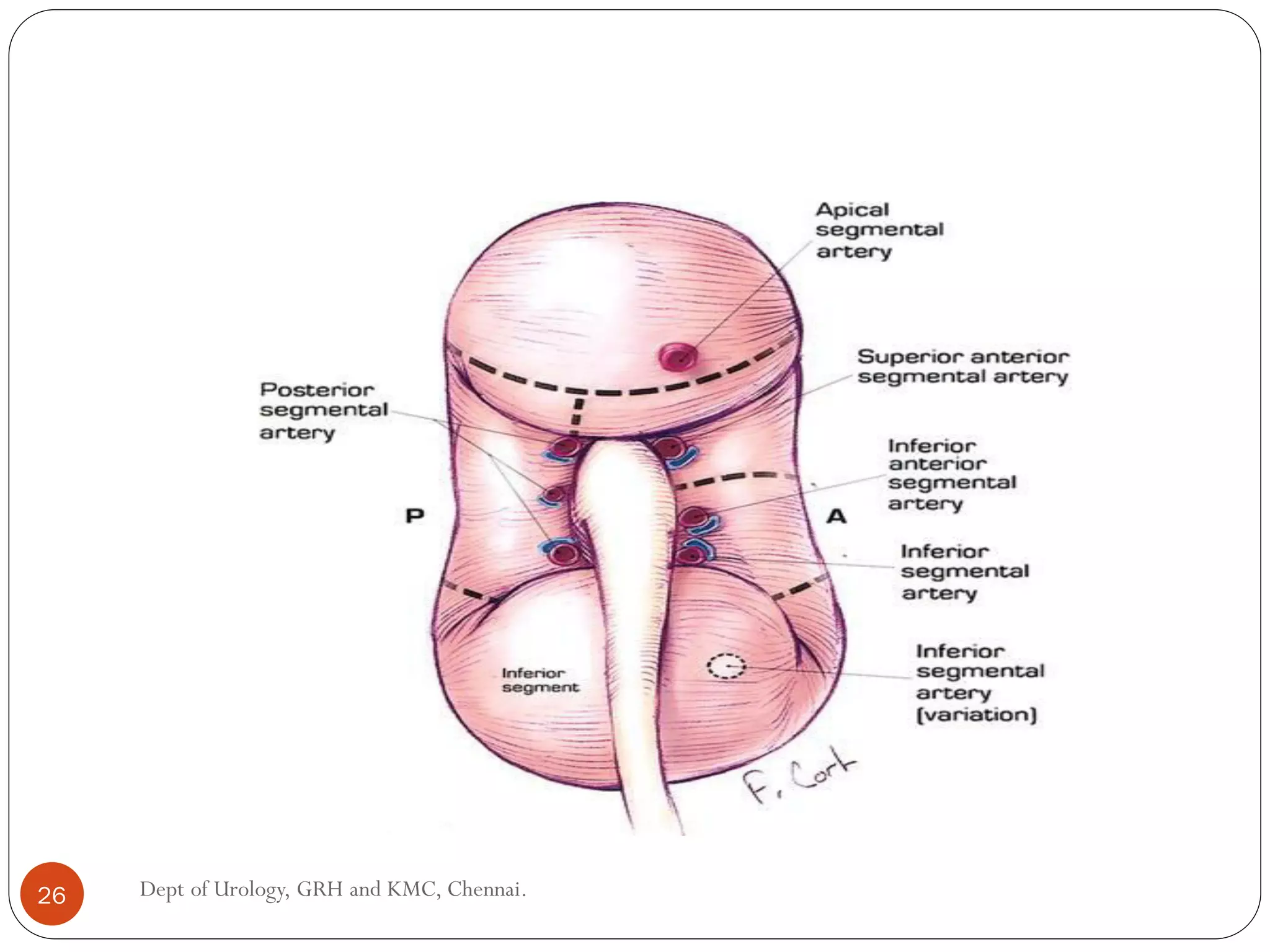 26 Dept of Urology, GRH and KMC, Chennai.
 