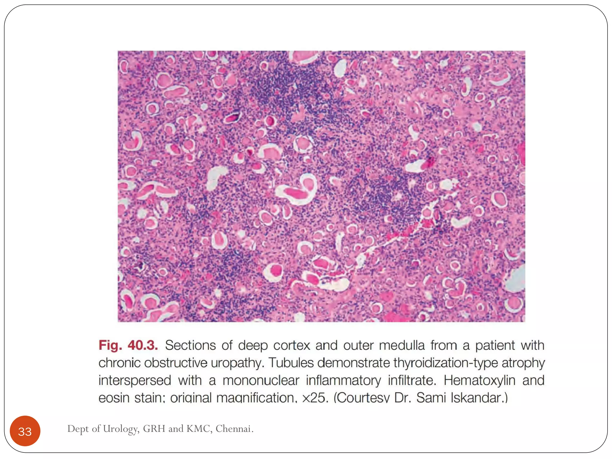 33 Dept of Urology, GRH and KMC, Chennai.
 