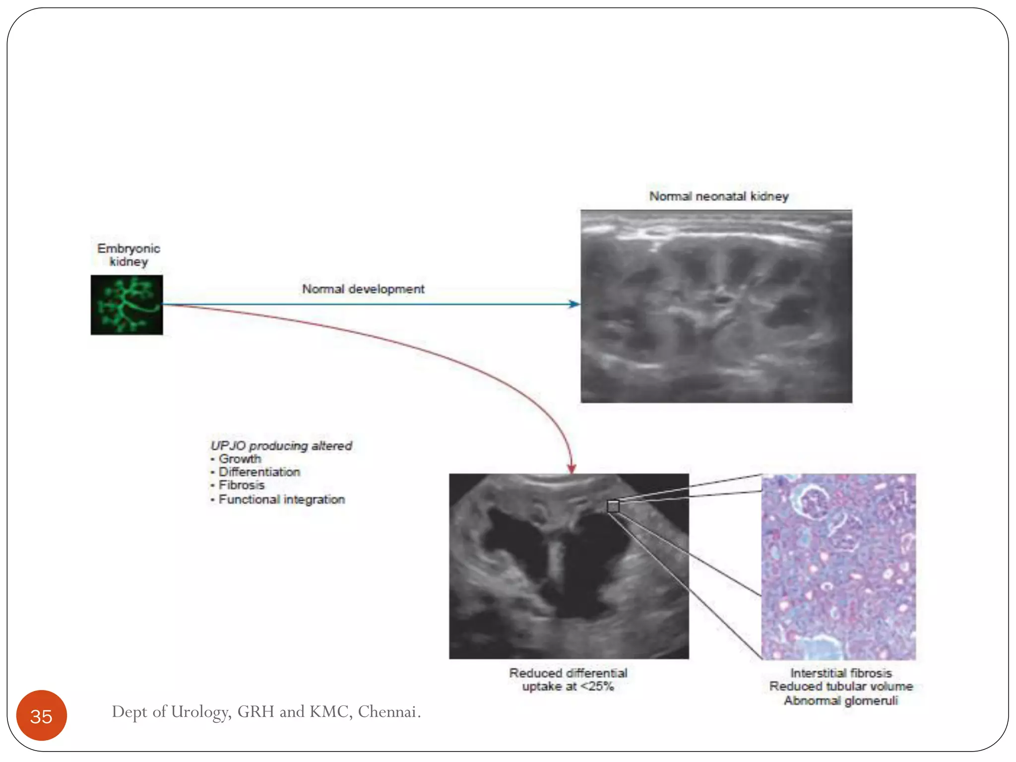35 Dept of Urology, GRH and KMC, Chennai.
 