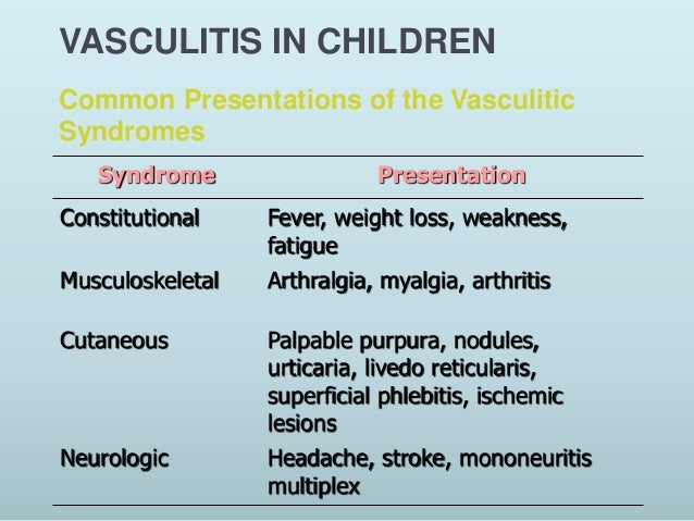 Vasculitis Child Kawasaki Weight Vasculitis Child Kawasaki Weight